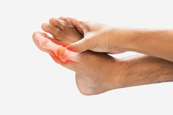 Person holding a foot inflamed by gout at the big toe joint